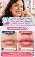 جهاز تكبير الشفاه الكهربائي — شفاه ممتلئة وجذابة بدون حقن  💋